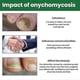 thumbnail image 4 of Onychomyx Nail Repair Nourishing Solution To Onyx Nails Bright Nails -, 4 of 4
