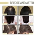 thumbnail image 5 of 3pcs Natural Hair Growth Oil, Veganic Organic Natural Hair Growth Oil 60ml, 5 of 5