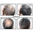 thumbnail image 2 of Toppik Hair Building Fibers Medium Brown .97oz, 2 of 2