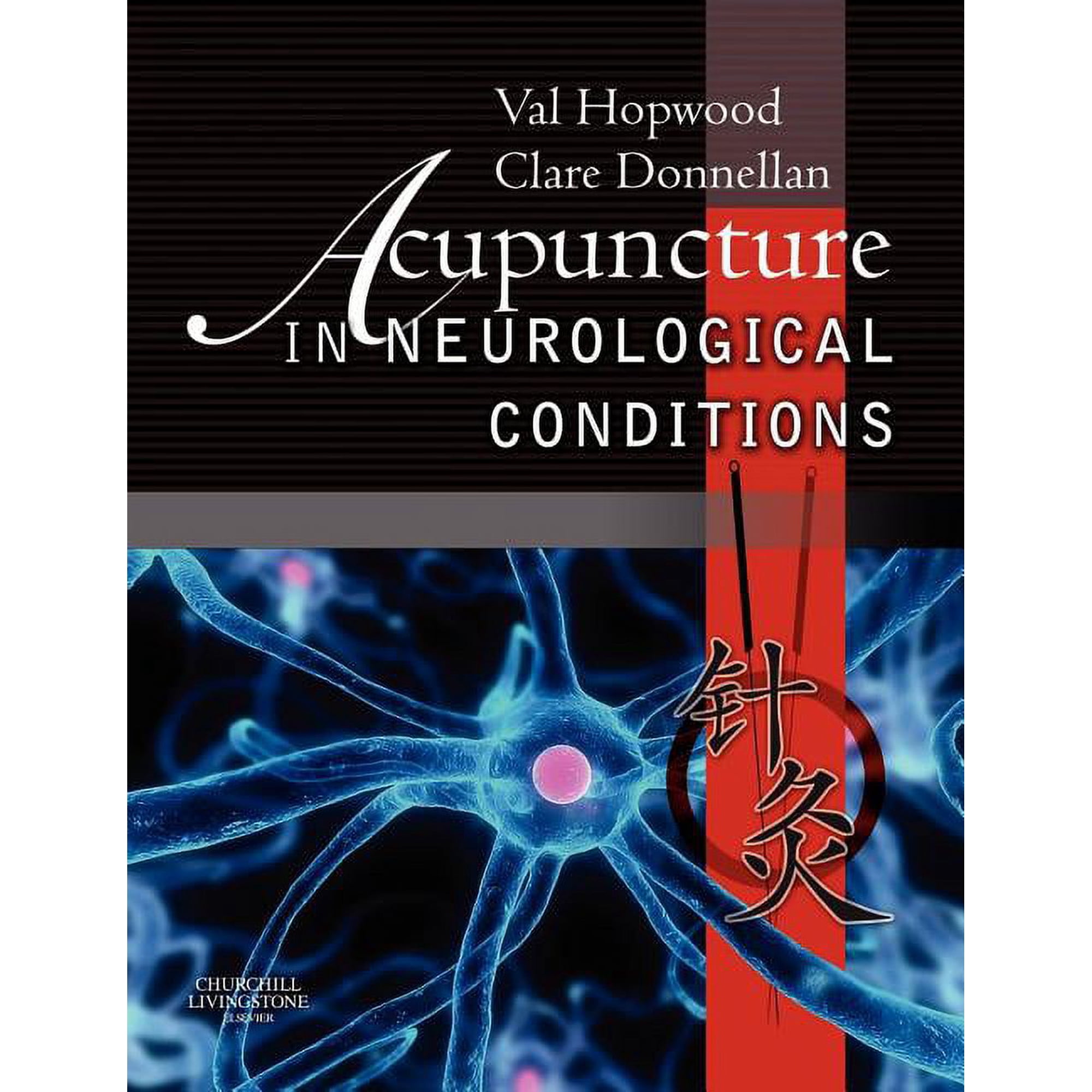 Acupuncture in Neurological Conditions (Other)