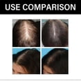 thumbnail image 2 of Hair Care Shampoo Deep Clean, Soft And Moisturizing Hair Root Anti-Set Hair Conditioner, 2 of 5