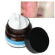 thumbnail image 5 of Tratamiento Del Acné facial ANGGREK Crema Para Eliminar El Acné, 5 of 7
