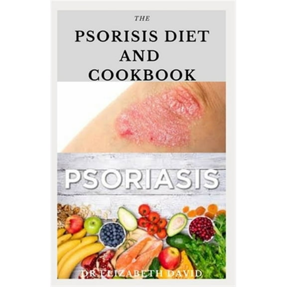 The Psoriasis Diet and Cookbook: Dietary Guide For Preventing and Healing Psoriasis: Includes (Paperback) by Dr Elizabeth David