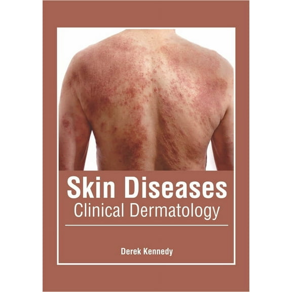 Skin Diseases: Clinical Dermatology, (Hardcover)