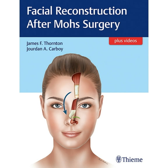 Facial Reconstruction After Mohs Surgery (Hardcover)