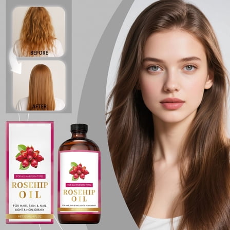 Rosehip Oil for Face and Hair Care, Cold Unrefined Facial Oil for Anti-Aging and Scar Moisturizing, 120ml Natural Oil for Deep Hydration, Nourishing Treatment for Dry Skin