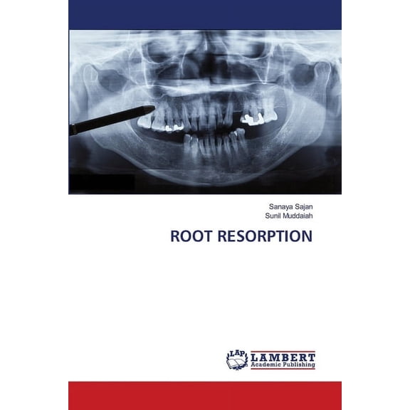 Root Resorption, (Paperback)
