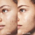 thumbnail image 4 of Crema hidratante e.l.f. SKIN Blemish Breakthrough Calming Water Cream, 4 of 6