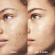 thumbnail image 4 of Crema hidratante e.l.f. SKIN Blemish Breakthrough Calming Water Cream, 4 of 6