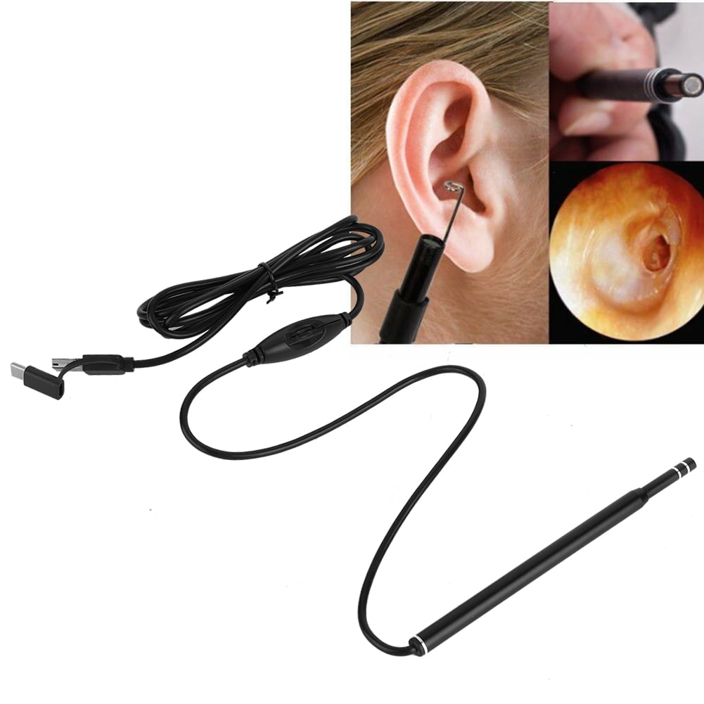 YLSHRF HD Earwax Removal Kit,3-in-1 Home Use Ear Cleaning Endoscope Earpick Camera HD Earwax Removal Kit,Ear Cleaning Endoscope