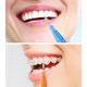 thumbnail image 2 of Soidarity 40 piezas Micro cepillo aplicador de dientes palo Mini cepillo de dientes de nailon Oficina escuela viaje herramienta de limpieza cuidado de los oídos 4 colores, 2 of 6