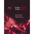 thumbnail image 1 of Brain Damage, Brain Repair, 1 of 1