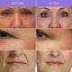 thumbnail image 2 of Sakura-crema facial antienvejecimiento, eliminador instantáneo de arrugas, líneas finas, reafirmante, reparación hidratante, cuidado de la piel, Cosméticos Coreanos, 2 of 5