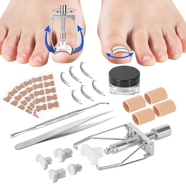 Kit de tratamiento de uñas encarnadas, kit de herramientas para uñas encarnadas: corrector de uñas encarnadas y aparatos ortopédicos para uñas de los pies
