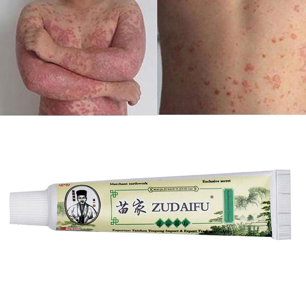 Buy BSMEAN 15g Chinese Herbal Psoriasis Skin Care Dermatitis Eczema ...
