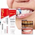 thumbnail image 4 of Fresh-Whitening Probiotics Toothpaste Effective Keep Oral Hygiene Tooth Paste for Daily Use, 4 of 5