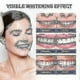 thumbnail image 5 of Jaysuing Toothbrush Tooth Cleaner Stain Remover Brightener And Whitener Mouth Cleaner To Get Rid Of Yellow Teeth And Tobacco |, 5 of 5