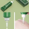 thumbnail image 3 of Cara del gel del retiro de la cicatriz del acné del árbol del té para reparar cicatrices y hoyos del acné 15g, 3 of 5