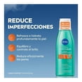 thumbnail image 3 of Tónico facial Nivea Derma skin clear anti-imperfecciones 200ml, 3 of 4