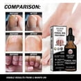 thumbnail image 3 of Nail Repair Liquid Thickening And Bright Nails, Nail Fungus, Dead Sk, 3 of 5