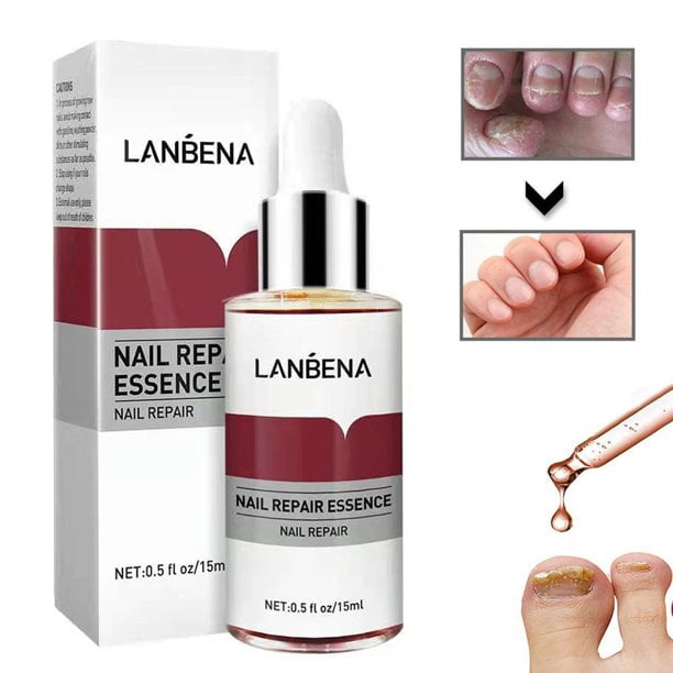 LANBENA esencia de reparación de uñas,CAIXIN serum hongo tratamiento eliminación de uñas ungueal tiña lustre nutrir cuidado de manos y pies CAIXIN Esencia de reparación de uñas