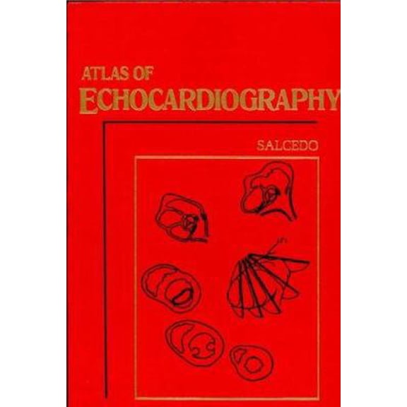 Pre-Owned Atlas of Echocardiography (Hardcover) 0721678998 9780721678993