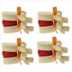 thumbnail image 1 of 4X Modelo de Vértebras Lumbares, Columna Anatómica, Hernia de Disco Lumbar, Herramienta de Enseñanza de Anatomía, Modelo de Vértebras Lumbares, 1 of 5