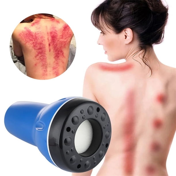 La última ventosa para raspar el cuerpo, quemador magnético, instrumento de raspado, dispositivo de ventosas de masaje para adultos, uso corporal completo, ventosa de dragado Gua Sha