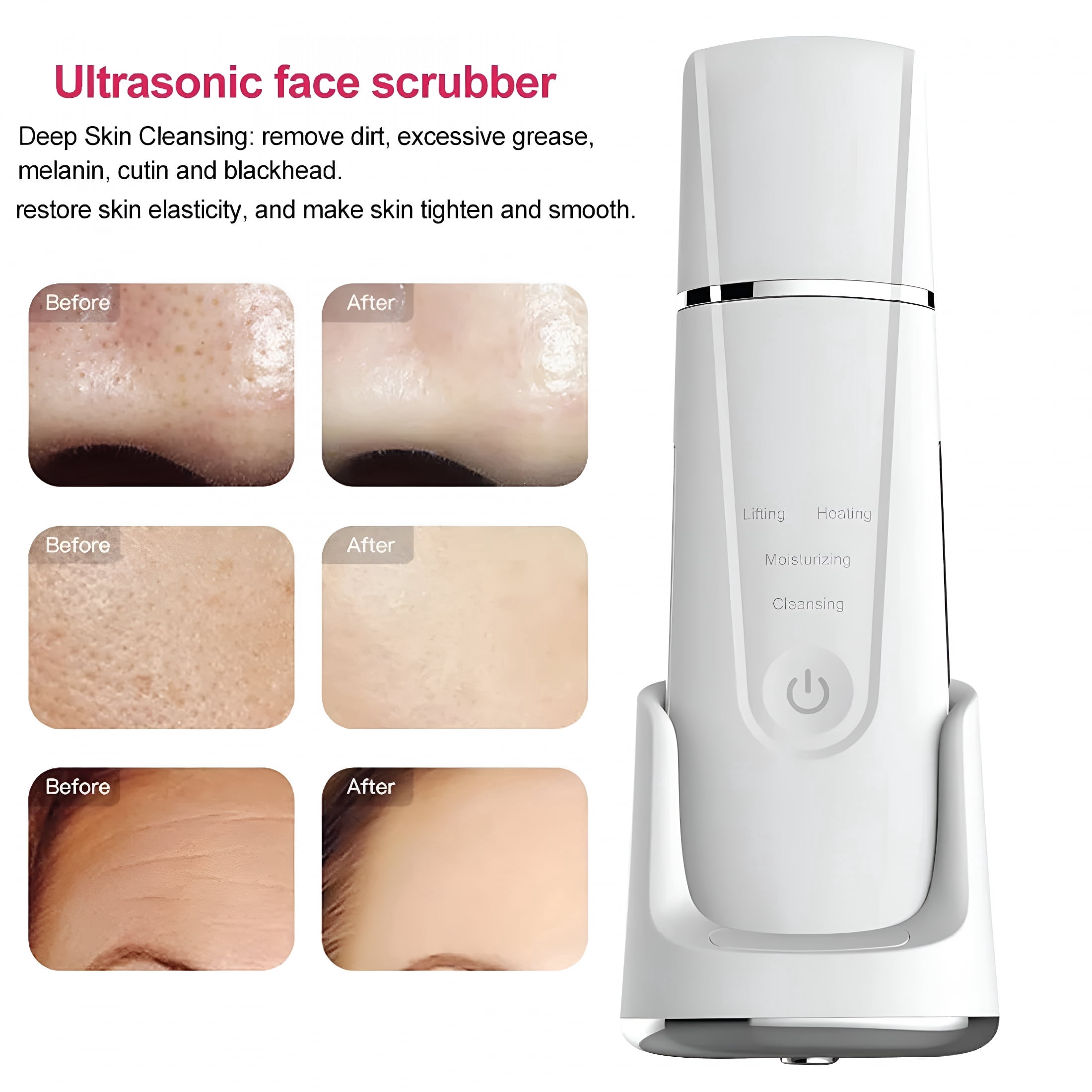 XIRQI 2026 New Ultrasonic Cleanser Skin Scrubber Face Spatula, Skin Spatula Pore Cleaner Blackhead Remover Tools for Facial Deep Cleansing, Skin Exfoliating Tool (Professional Series-Black)
