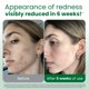 thumbnail image 2 of Toallas faciales CLEAN SKIN CLUB para piel sensible XL 50 unidades, 2 of 9