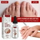thumbnail image 3 of Anti-Fungal Soothing Oil Foot Care Inner Nail Repair Essence Pedicure Nails Whitening Onychomycosis Relief Oil, 3 of 5