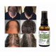 thumbnail image 3 of Herbal Hair Growth Essence Mist, Hair Tonic Mist, Hair Growth Herbal Mist, Anti-hair Loss Mist, Suitable For Men And Women Of All Hair Types, 3 of 4