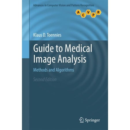 ISBN 9781447173182 product image for Advances in Computer Vision and Pattern Recognition: Guide to Medical Image Anal | upcitemdb.com