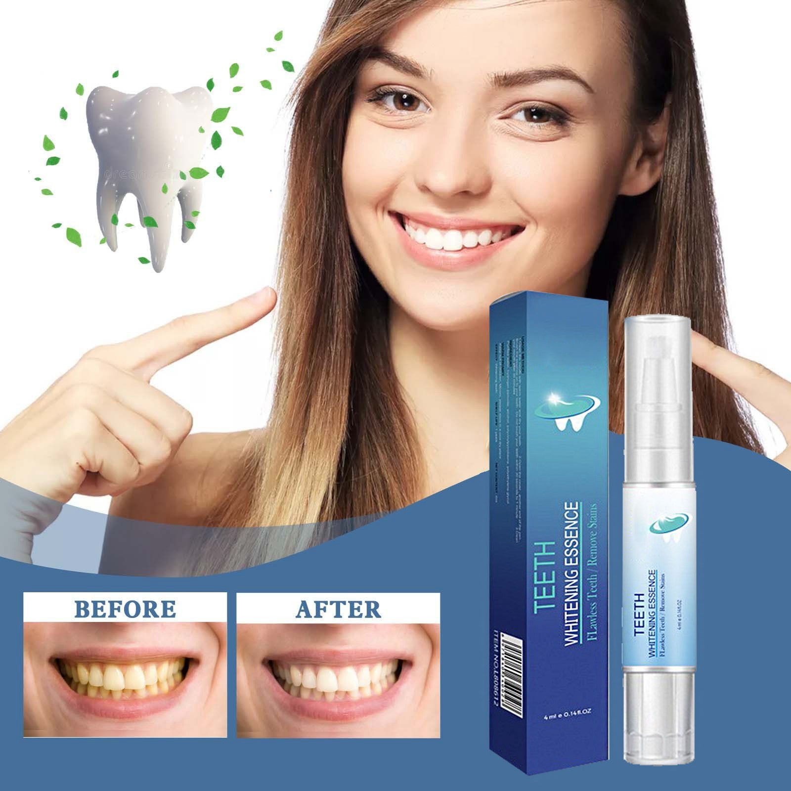 Luoyaxxxxx Close up Toothpaste Teeth Gum Gel Teethwhitening Cleaning ...