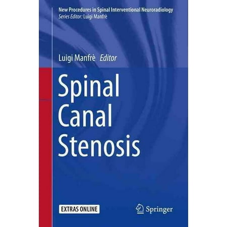 Spinal Canal Stenosis (New Procedures in Spinal Interventional Neuroradiology) (Best Exercises For Cervical Spinal Stenosis)