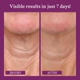 thumbnail image 3 of Crema para el cuello PRAI Beauty Ageless Throat & Escoletage 200 ml, 3 of 9