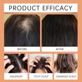 thumbnail image 4 of Fashionable Essential oils Oil Essential Batana Care Oil,Hair Care Oil,Batana Sodium Hair Care Oil,Hair Care,Strengthen Hair,Damaged Hair Follicles,Moisturize The Scalp,60ml(buy 2 get 10% off), 4 of 5