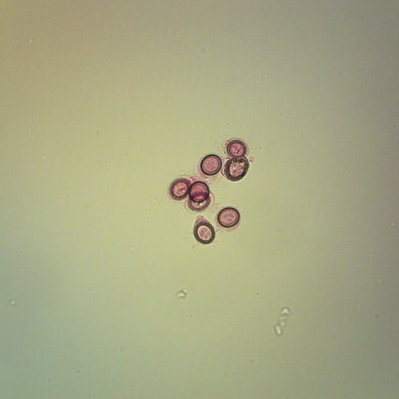 Echinococcus Granulosus Eggs Slide, W.M.