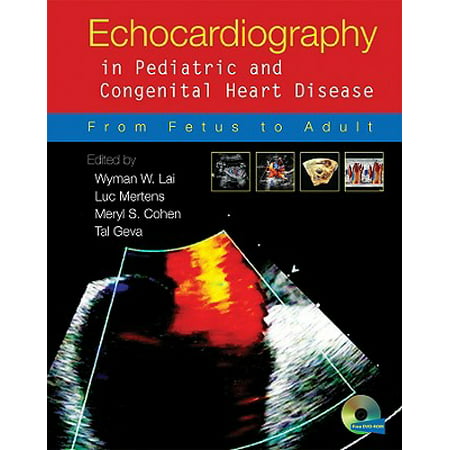 Echocardiography in Pediatric