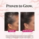 thumbnail image 5 of Suplementos para el crecimiento del cabello Viviscal para mujeres 180 tabletas, 5 of 6