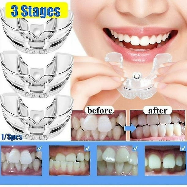 Corrector de dientes de ortodoncia dental, retenedor de aparatos de silicona, herramientas para enderezar los dientes con tapa para adultos OL