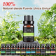 thumbnail image 5 of Kit De 12 Aceites Esenciales Aromaterapia 100% Puro 10ml Spa, 5 of 5