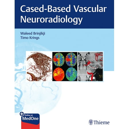 UPC: 9781684200535 | Imaging in Neurovascular Disease: A Case-Based Approach (Paperback)