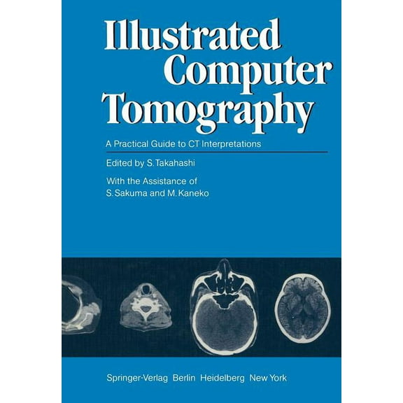 Illustrated Computer Tomography: A Practical Guide to CT Interpretations, (Paperback)