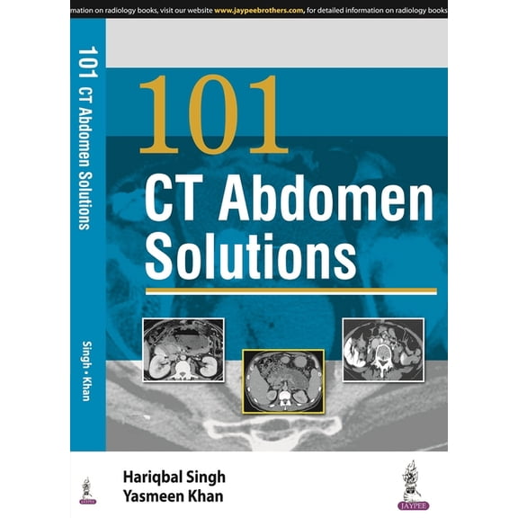 101 CT Abdomen Solutions (Paperback) by Hariqbal Singh, Yasmeen Khan