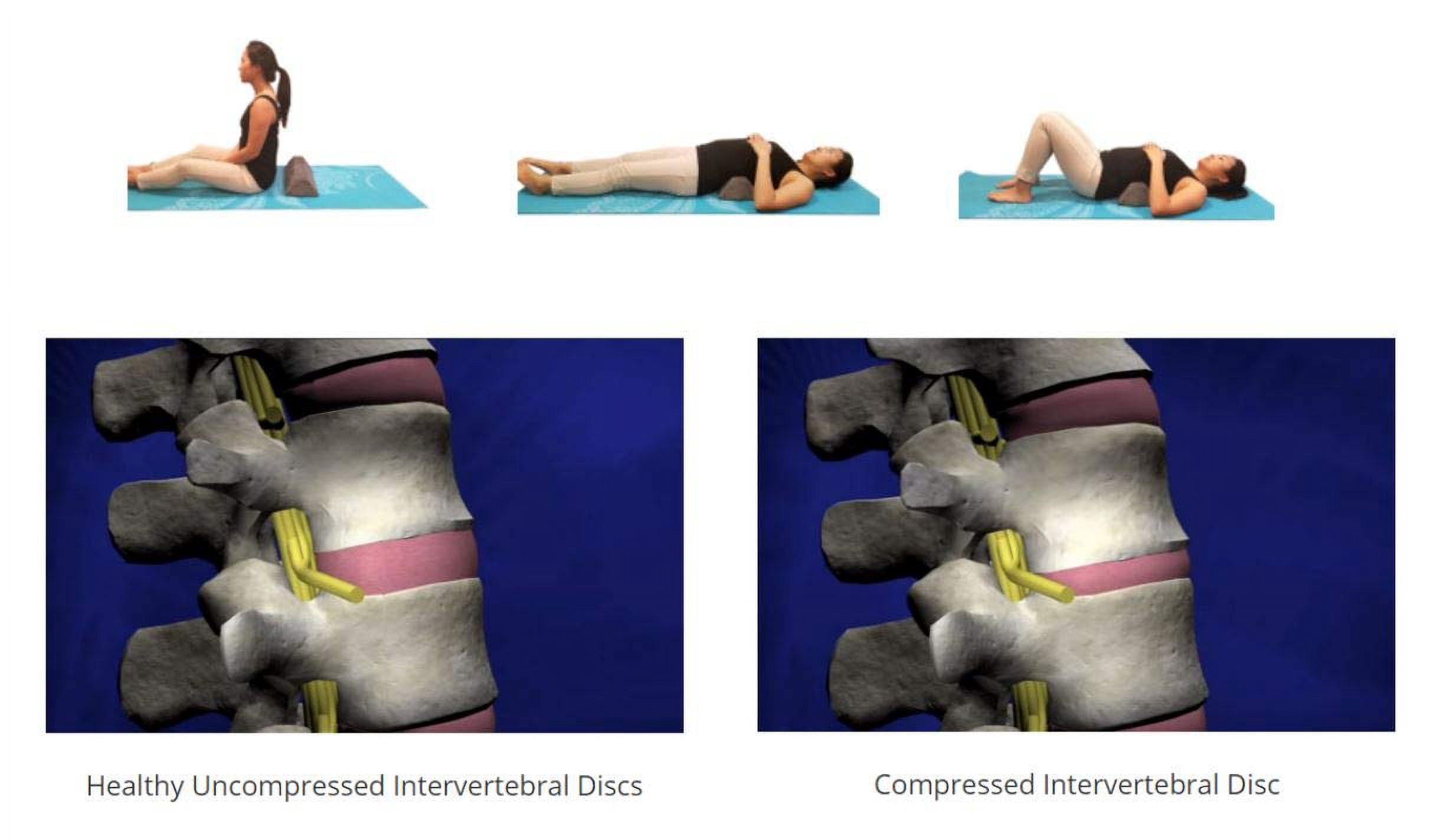 Lumbar Traction Fulcrum , Firm , Gentle Posture Corrector , Lower Back Stretcher Device , Spine Stretcher , Back Traction