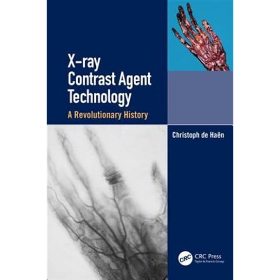 Pre-Owned X-Ray Contrast Agent Technology: A Revolutionary History (Hardcover)
