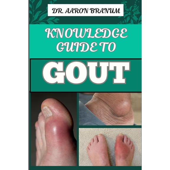Knowledge Guide to Gout: Essential Manual To Symptoms, Treatments, Diets, And Natural Remedies For Lasting Relief, (Paperback)