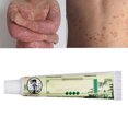 thumbnail image 1 of Pomada en crema para el cuidado de la piel pomada en crema a base de hierbas Cnidium Kochia Scoparia Sophora Flavescens 15g de menta para psoriasis ANGGREK Otros, 1 of 8