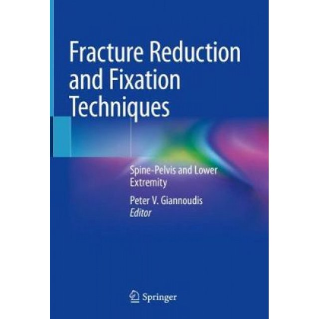 Techniques de Réduction et de Fixation des Fractures : Colonne Vertébrale-Pelvis et Membres Inférieurs